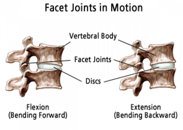 Facet Joint all vertebra. Zygapophyseal Joint. Facet перевод